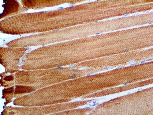 IHC of Actin, Muscle-Specific on an FFPE Skeletal Muscle Tissue